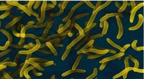 微生物菌劑好？好在哪里您知道嗎？